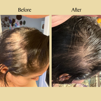 Veganic Hair Growth Gummies