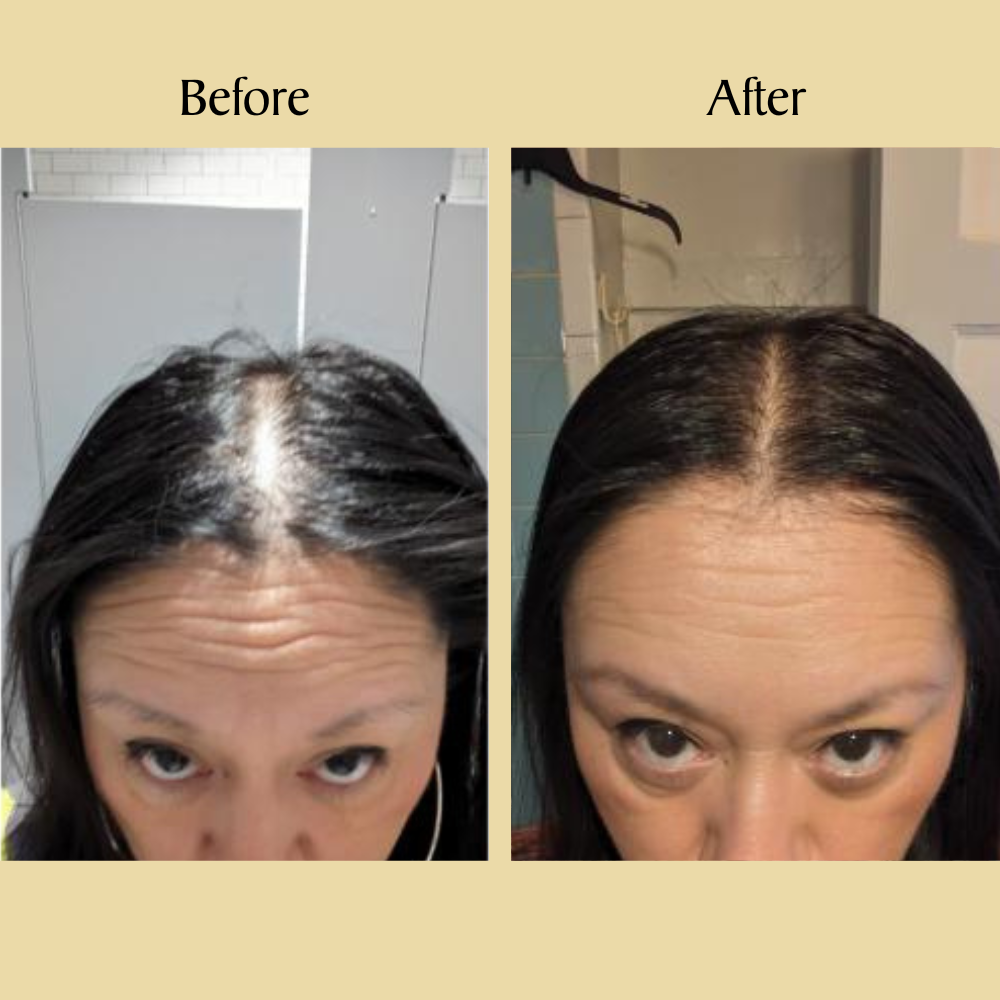 Veganic Natural Hair Growth Oil - Subscribe & Save